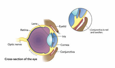 Feline Conjunctivitis: Essential Facts Every Cat Owner Needs to Know