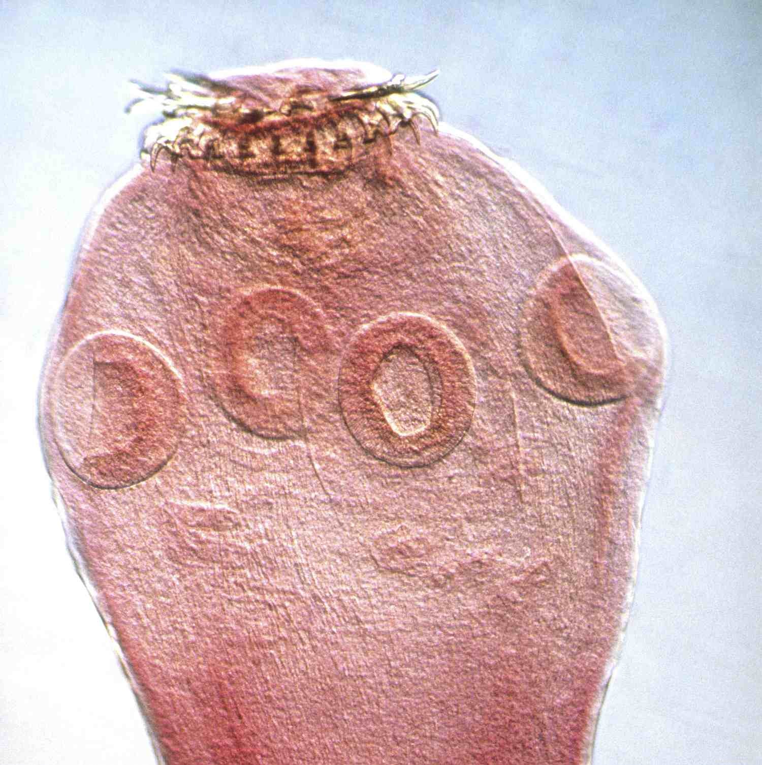 Hidden Threats: Managing Internal Parasites in Horses