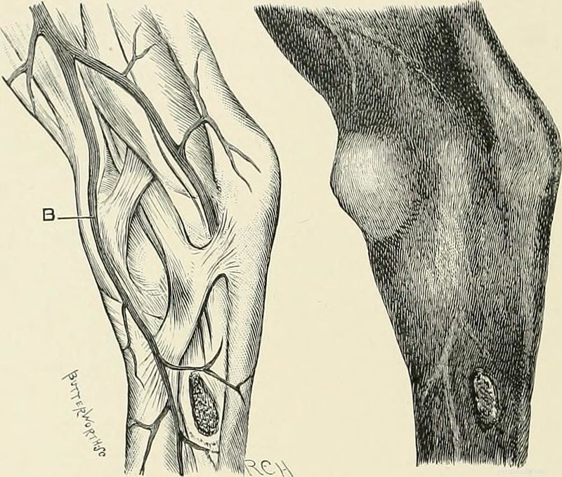 Horses Hind Leg Issues: Causes, Diagnosis, and Treatment