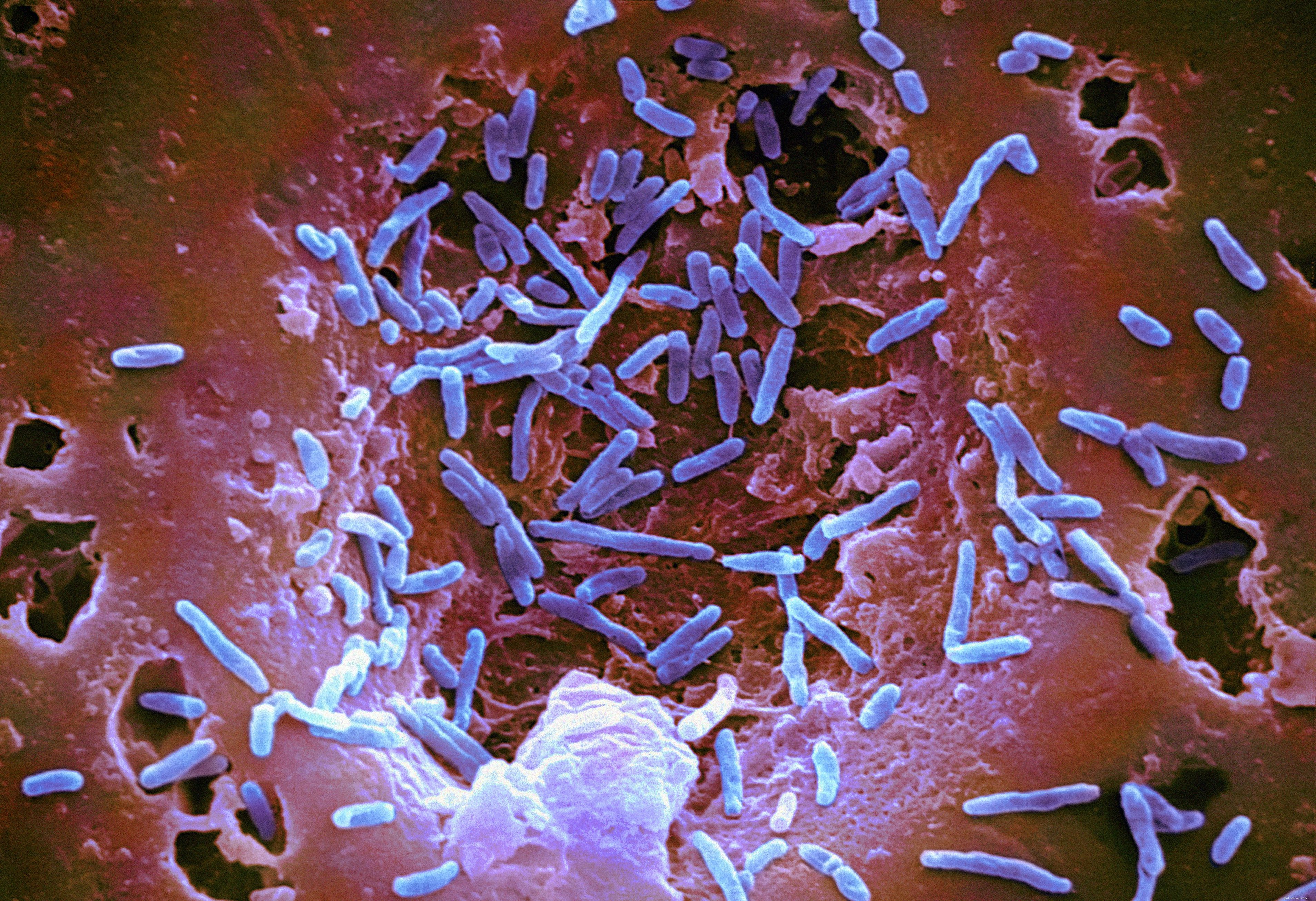 Understanding Salmonella: Symptoms, Risks, and Effective Treatments
