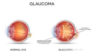 7 Common Eye Disorders in Dogs and How to Manage Them