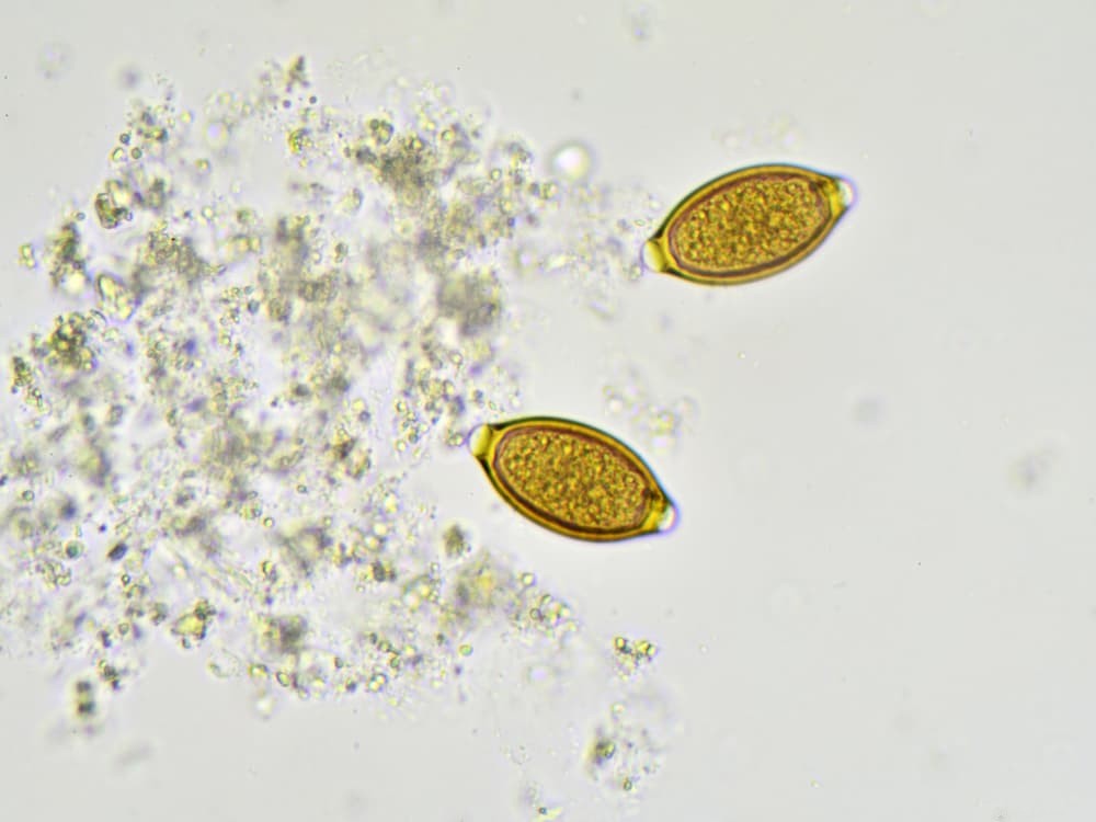 Whipworm Infections in Dogs: Symptoms, Diagnosis, and Treatment