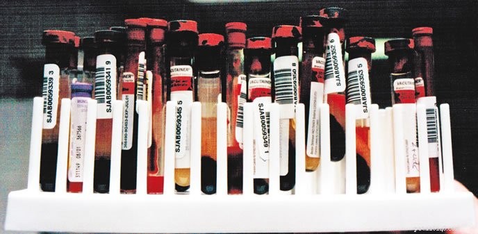 Essential Canine Blood Test Values: What They Reveal About Your Dog’s Health