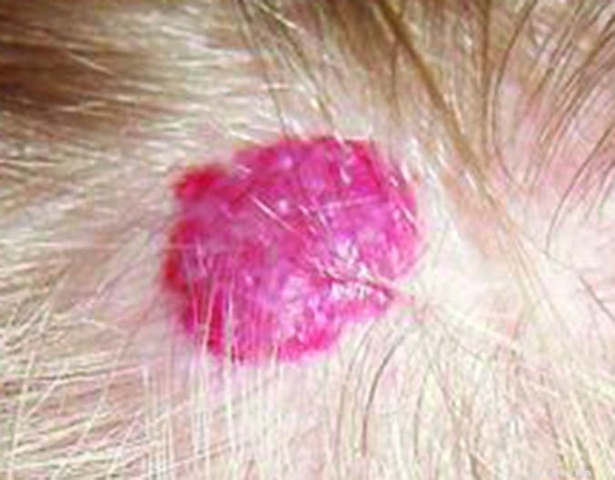 Understanding Hemangiomas in Dogs: Causes, Symptoms, and Care