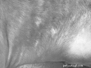Ringworm Unveiled: A Fungal Infection, Not a Worm