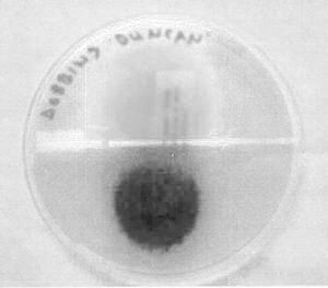 Ringworm Unveiled: A Fungal Infection, Not a Worm