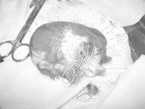 Understanding Heartworm: Causes, Symptoms, and Prevention