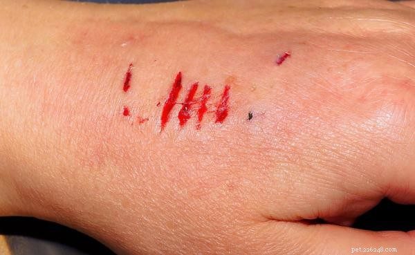 My Dog Bit Me: Causes, Symptoms, and How to Protect Yourself