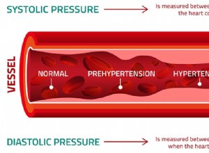 Vysoký krevní tlak u psů (hypertenze):Stručný průvodce
