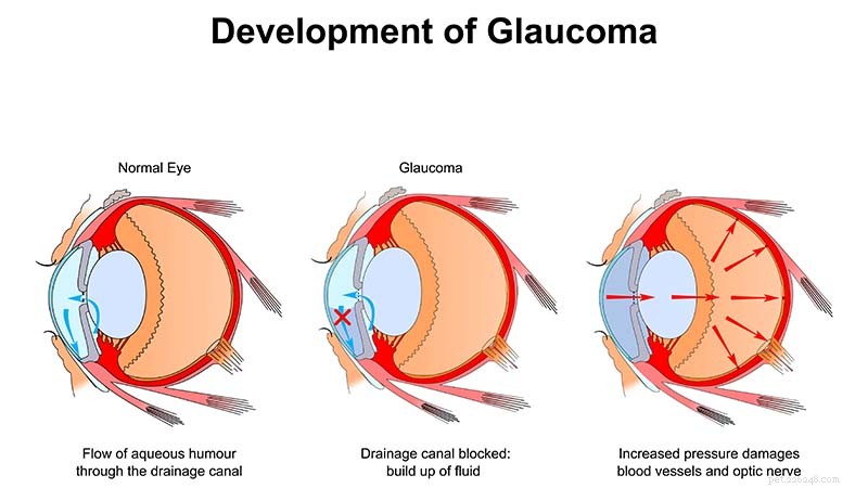 glaucoom bij honden:oorzaken, symptomen, behandeling