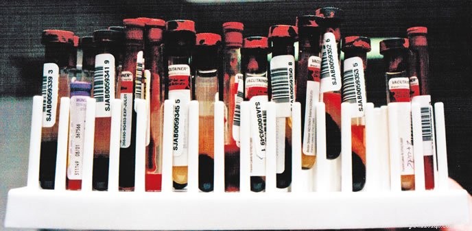 Valores comuns em um exame de sangue canino