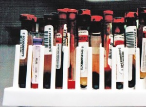 Běžné hodnoty v testu psí krve